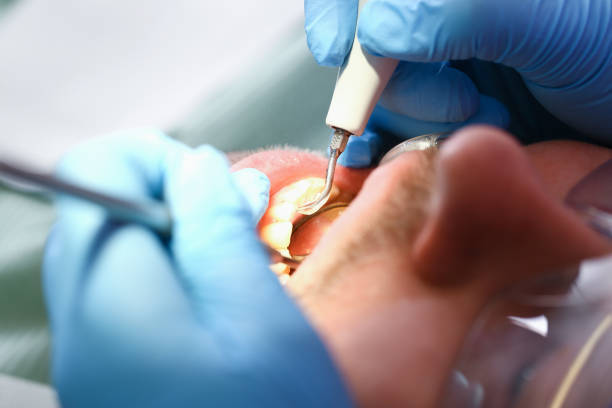 Best Pediatric Emergency Dentist in Fort Worth, TX